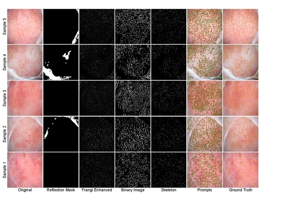 Multimodal LLM-Assisted Analysis for Oral Mucosal Imaging