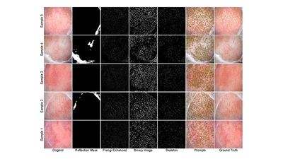 Multimodal LLM-Assisted Analysis for Oral Mucosal Imaging featured image