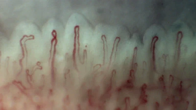 Zero-Shot Capillary Segmentation in Dermoscopy Images via SAM2: A Case Study on Oral Mucosa featured image